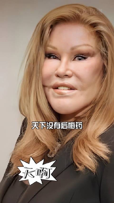 乔斯林去世5个月后整容四巨头现状曝光刘晓庆金老佛爷邵音音引关注