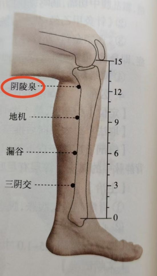 图中标红为阴陵泉穴。（受访者供图）