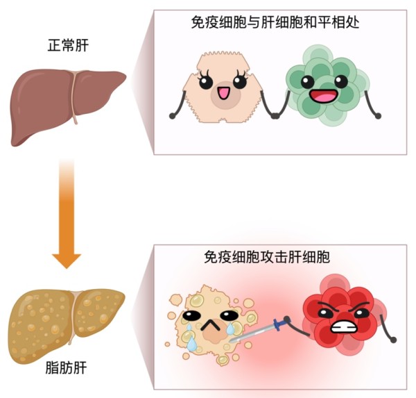 脂肪肝发病机制的简易模式图