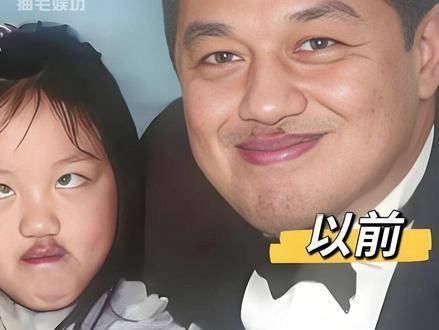 王菲二女儿李嫣唇部恢复如初