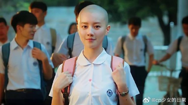 青春总是无敌,即使你没有一根头发