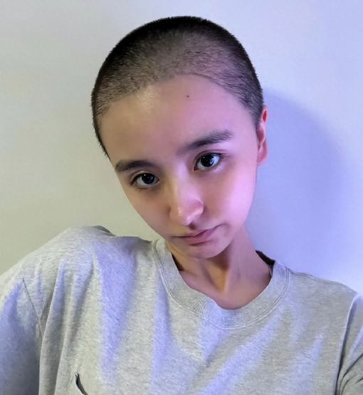 金子涵退圈后抑郁状况堪忧，剃光头行为怪异，章子怡郝蕾或需担责