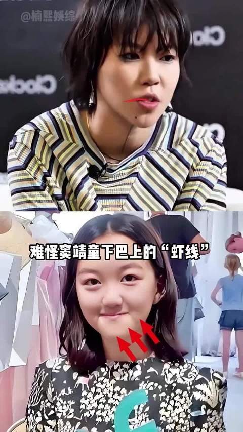 为何窦靖童的“虾线”与李嫣的“兔唇”会一同消失?