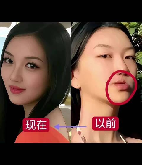 李嫣微整后神似王菲,遗传母亲清冷美艳气质