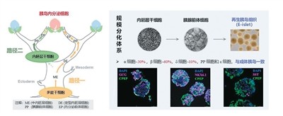 1型糖尿病治疗迎来新路径