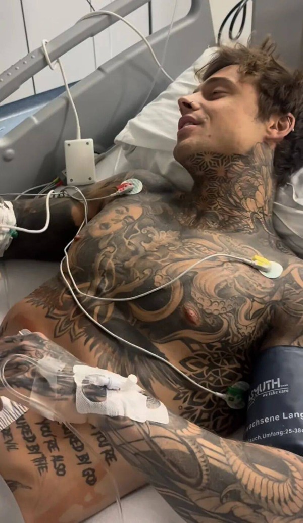 《德国超模大赛》的男模突然住院