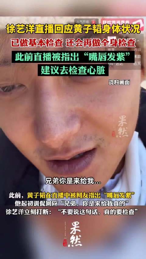 徐艺洋让黄子韬做全身检查,此前网友发现黄子韬嘴唇发紫,建议其去检查心脏