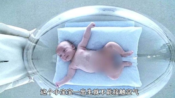 小男孩得了怪病，碰到空气就会立马没命！