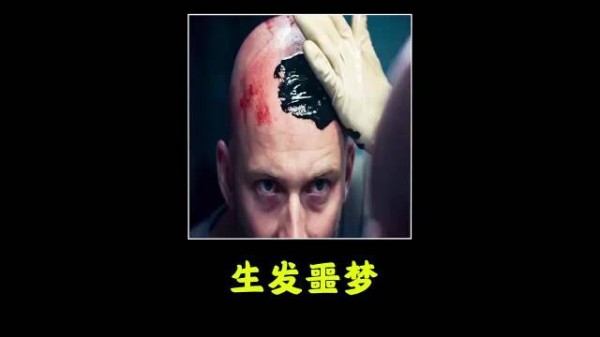 为长出头发猛涂生发液，三小时后头皮长出脓包