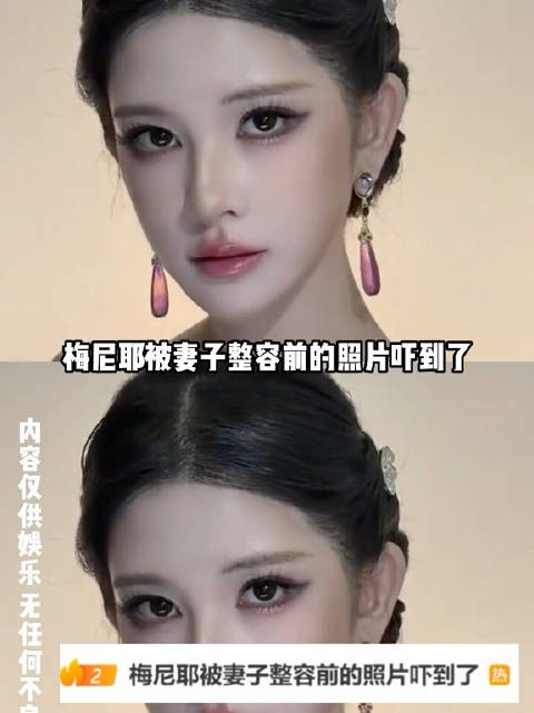 梅尼耶被妻子整容前的照片吓到了