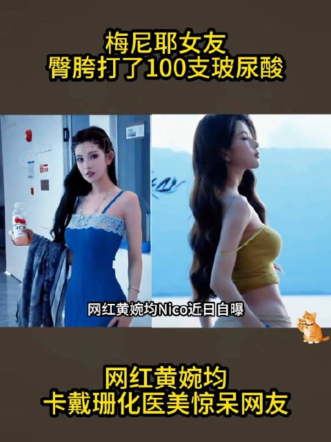 梅尼耶女友臀胯又打了100支玻尿酸，网友：审美逐渐卡戴珊化 ？