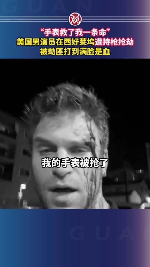 “手表救了我一条命”,美国男演员在西好莱坞遭持枪抢劫,被劫匪打到满脸是血