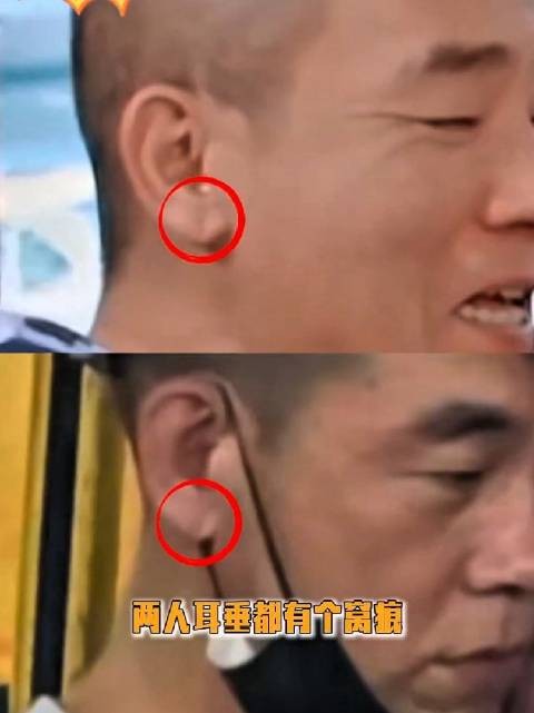 多重巧合层层叠加！陈小春和疑似弟弟耳朵都有个窝痕