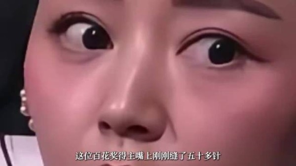 负伤领奖,孤身下台,她是卫诗雅,百花奖唯一香港籍女演员得主!